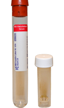 Specimen Collection | Medical Diagnostic Laboratories